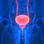 Aceites esenciales para la salud de la próstata